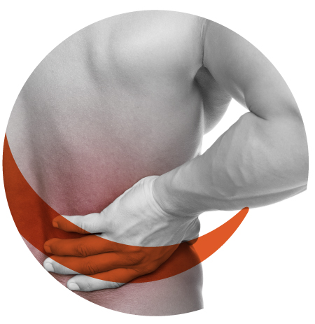 NTG-101 on Back Pain